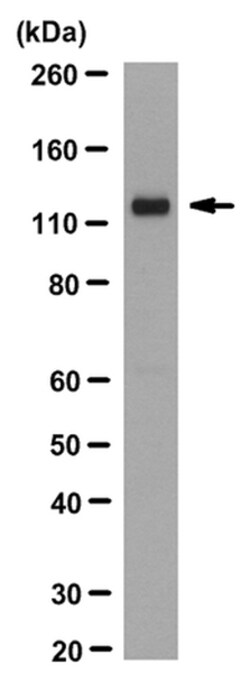 MilliporeSigma anti-ROR2 Clone: Nt2535-2835, 100&mu;g, Unlabeled:Antibodies,